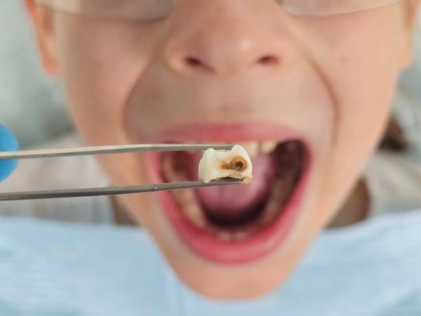 Best Urgent Tooth Repair  in San Bernardino, CA