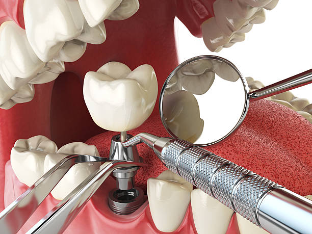 Best Emergency Dentist Near Me  in San Bernardino, CA