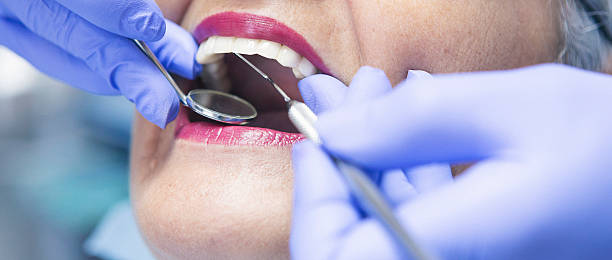 Best Chipped Tooth Repair Near Me  in San Bernardino, CA