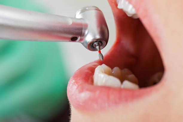 Best Dentist Open Late Near Me  in San Bernardino, CA